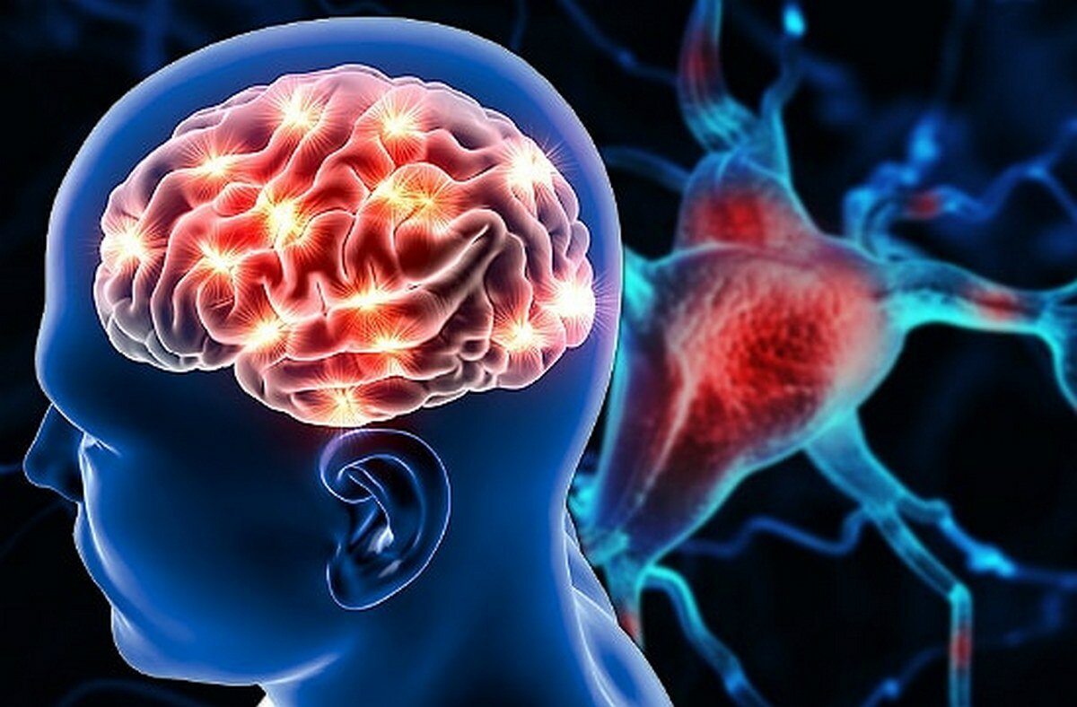 Американские исследователи нашли новый метод диагностирования инсульта