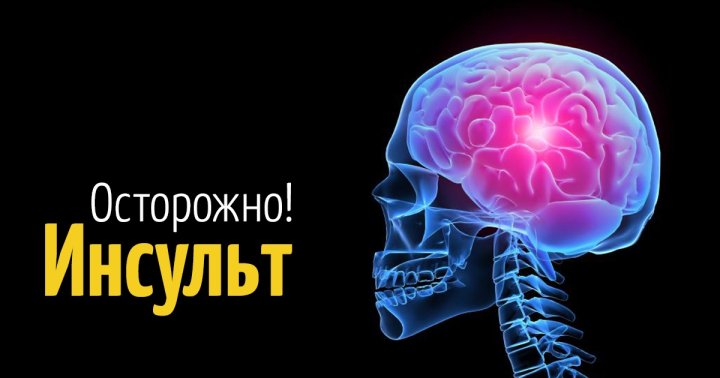В Узбекистане «помолодел» инсульт