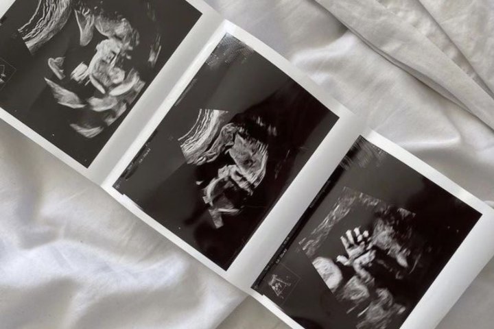 Акушеры из Узбекистана осваивают передовые технологии, направленные на снижение материнской и младенческой смертности