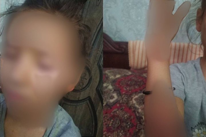 В Бухаре женщина прижигала шумовкой 9-летнюю дочь