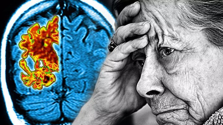 Найдено средство против рака и Альцгеймера