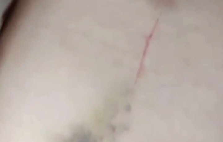 В Чиназе муж избил свою жену, она несколько дней находится в реанимации без сознания