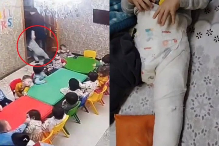 В одном из частных детсадов Ташкента сломали ногу ребёнку
