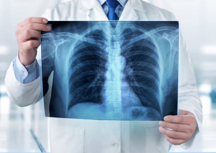 В Ташобласти арестовали рентгенолога, схватившего пациента за половой орган