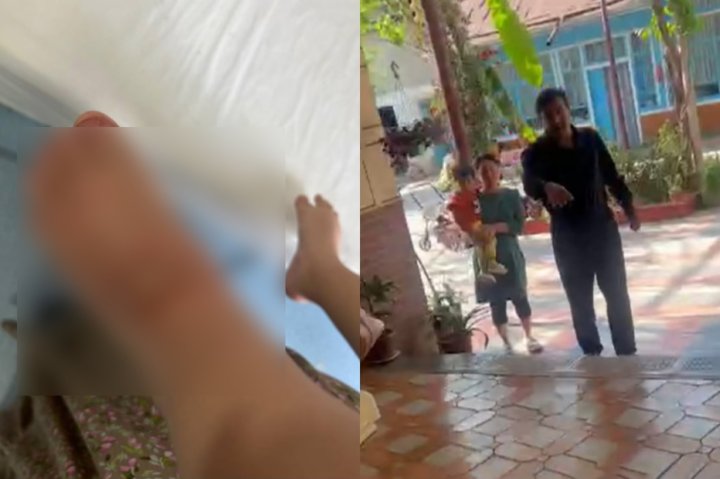 В одном из детских садов Намангана на ногу полуторагодовалой малышки пролили кипяток