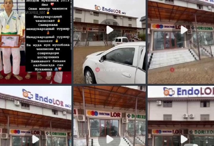 Из-за смерти 11-летнего мальчика в частной клинике Бухары возбуждено уголовное дело