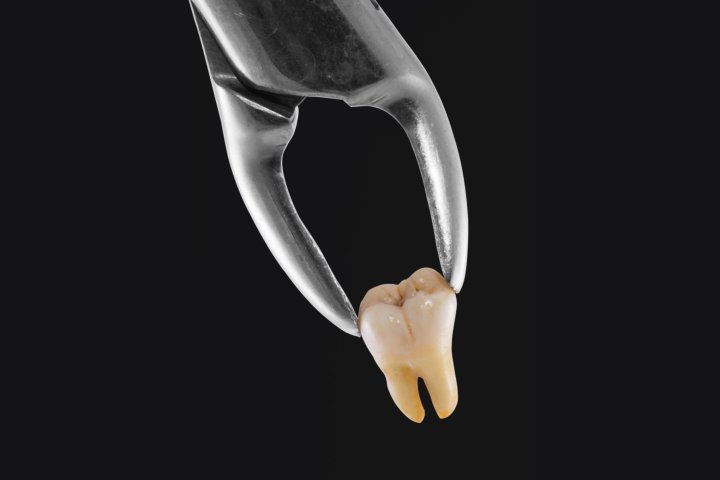 Учёные впервые вырастили человеческие зубы