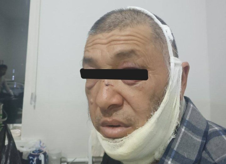 В Андижанской области избили 52-летнего мужчину