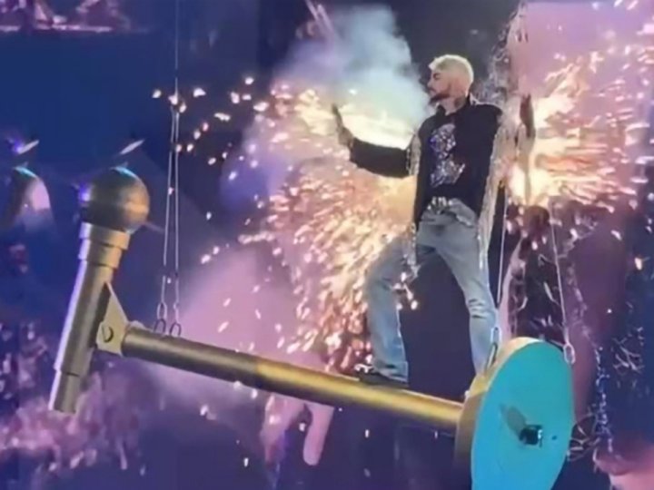 Филипп Киркоров госпитализирован в Москве из-за осложнений после ожога