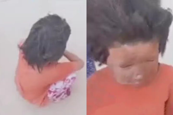 В Андижане 4-летняя девочка получила ожог лица из-за короткого замыкания в трансформаторе — видео