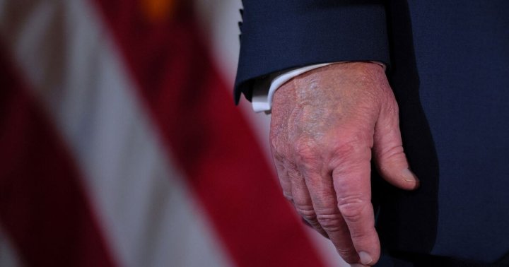 Врачи Белого Дома констатировали болезнь у Дональда Трампа