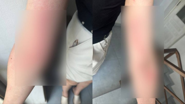 В Ташкенте девушку избил водитель такси