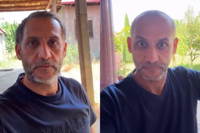 Узбекский певец Жахонгир Отажонов стал лысым