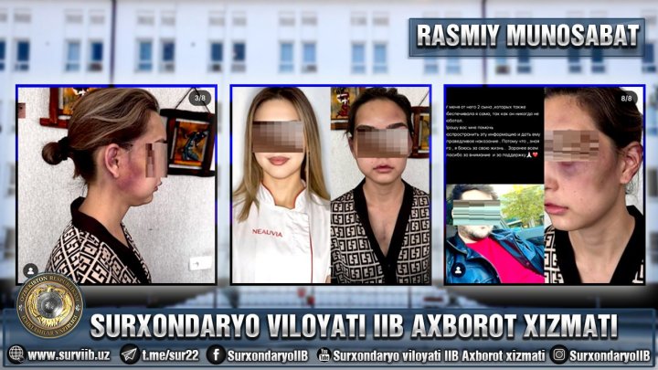 В Термезе мужчина жестоко избил свою жену, ей пришлось убежать из дома