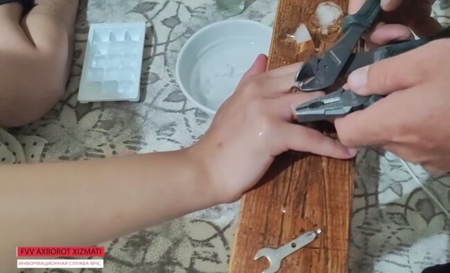 Спасатели МЧС в Нукусе пришли на помощь девочке, у которой на пальце застряло кольцо