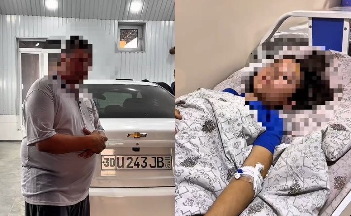 В Самарканде водитель автомобиля «Lacetti» сбил девочку и скрылся с места происшествия