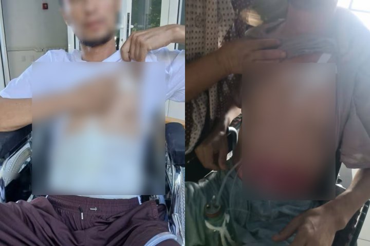 В МВД прокомментировали информацию о пытках мужчины в здании ОВД