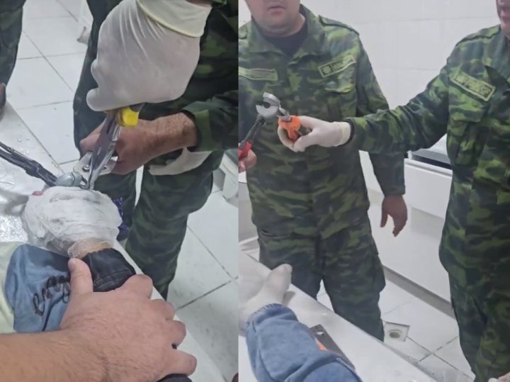 В Ташкенте мальчик едва не остался без пальца