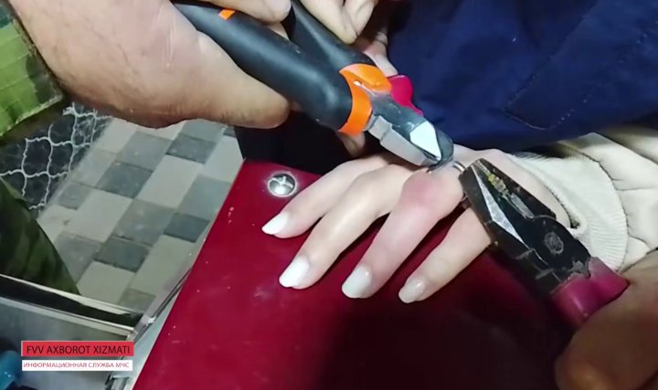 В Кибрае сотрудники МЧС помогли девушке снять кольцо с пальца