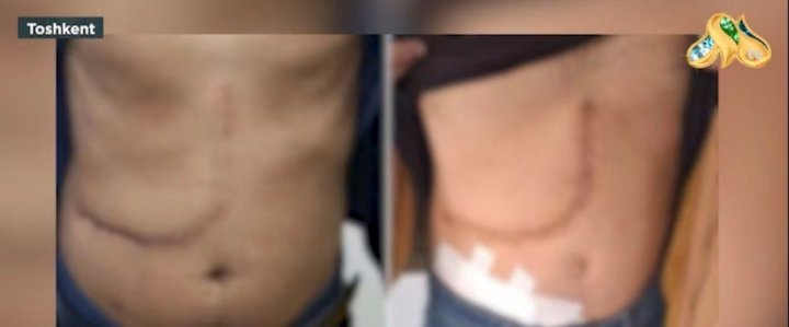 В Ташкенте преступная группа торговала человеческими органами